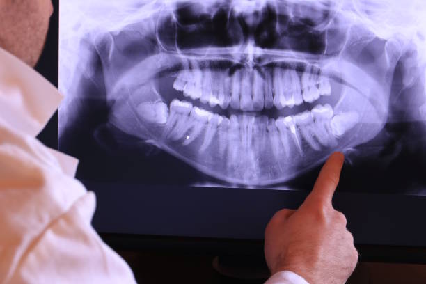 Best Emergency Dental Care for Broken or Chipped Teeth in Rollingwood, CA