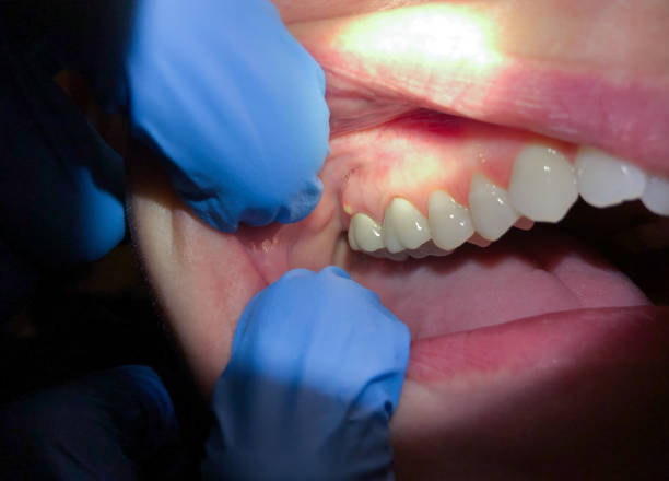 Best Cosmetic Emergency Dentistry in Rollingwood, CA