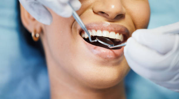 Best Emergency Treatment for Dental Infections or Abscesses in Rollingwood, CA