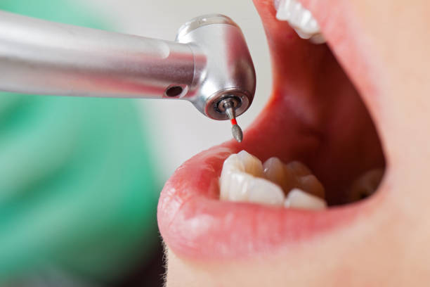 Best Emergency Denture Repair in Rollingwood, CA